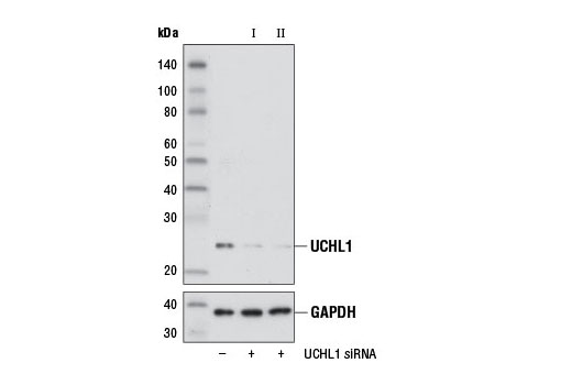 Western blot analysis of extracts from 293T cells, transfected with 100 nM SignalSilence ® Control siRNA (Unconjugated) #6568 (-), SignalSilence ® UCHL1 siRNA I (+), or SignalSilence ® UCHL1 siRNA II #12415 (+), using UCHL1 (D8R2I) XP ® Rabbit mAb #11896 (upper) or GAPDH (D16H11) XP ® Rabbit mAb #5174 (lower). The UCHL1 (D8R2I) XP ® Rabbit mAb confirms silencing of UCHL1 expression, while the GAPDH (D16H11) XP ® Rabbit mAb is used as a loading control.