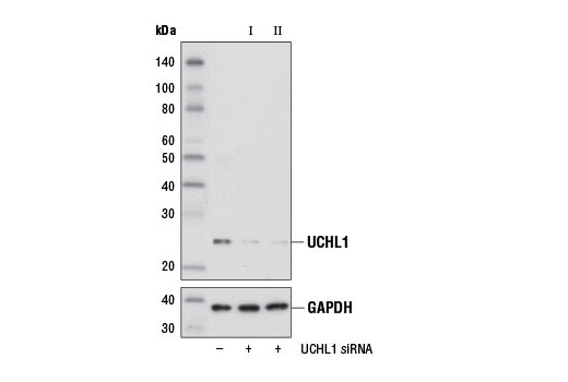 Western blot analysis of extracts from 293T cells, transfected with 100 nM SignalSilence ® Control siRNA (Unconjugated) #6568 (-), SignalSilence ® UCHL1 siRNA I # 12353 (+), or SignalSilence ® UCHL1 siRNA II (+), using UCHL1 (D8R2I) XP ® Rabbit mAb #11896 (upper) or GAPDH (D16H11) XP ® Rabbit mAb #5174 (lower). The UCHL1 (D8R2I) XP ® Rabbit mAb confirms silencing of UCHL1 expression, while the GAPDH (D16H11) XP ® Rabbit mAb is used as a loading control.