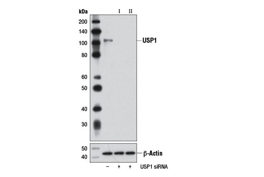 Western blot analysis of extracts from HeLa cells, transfected with 100 nM SignalSilence ® Control siRNA (Unconjugated) #6568 (-), SignalSilence ® USP1 siRNA I #6490 (+) or SignalSilence ® USP1 siRNA II (+), using USP1 (D37B4) Rabbit mAb #8033 (upper) or β-Actin (D6A8) Rabbit mAb #8457 (lower). The USP1 (D37B4) Rabbit mAb confirms silencing of USP1 expression, while the β-Actin (D6A8) Rabbit mAb is used as a loading control.