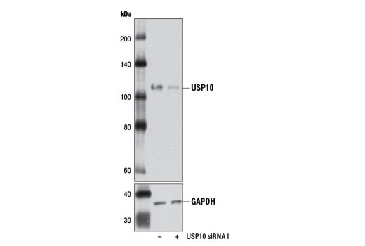 Western blot analysis of extracts from 293T cells, transfected with 100 nM SignalSilence ® Control siRNA (Unconjugated) #6568 (-) or SignalSilence ® USP10 siRNA I (+), using USP10 (D7A5) Rabbit mAb #8501 and GAPDH (14C10) Rabbit mAb #2118. The USP10 (D7A5) Rabbit mAb confirms silencing of USP10 expression, while the GAPDH (14C10) Rabbit mAb is used as a loading control.