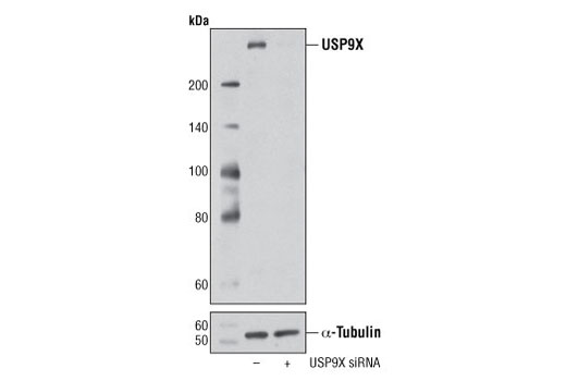 Western blot analysis of extracts from HeLa cells, transfected with 100 nM SignalSilence ® Control siRNA (Unconjugated) #6568 (-) or SignalSilence ® USP9X siRNA I (+), using USP9X Antibody #5751 (upper) or α-Tubulin (11H10) Rabbit mAb #2125 (lower). The USP9X Antibody confirms silencing of USP9X expression, while theα-Tubulin (11H10) Rabbit mAb is used as a loading control.