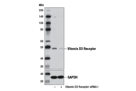 Western blot analysis of extracts from 293T cells, transfected with 100 nM SignalSilence ® Control siRNA (Unconjugated) #6568 (-) or SignalSilence ® Vitamin D3 Receptor siRNA I (+), using Vitamin D3 Receptor (D2K6W) Rabbit mAb #12550 (upper) or GAPDH (D16H11) XP ® Rabbit mAb #5174 (lower). The Vitamin D3 Receptor (D2K6W) Rabbit mAb confirms silencing of vitamin D3 receptor expression, while the GAPDH (D16H11) XP ® Rabbit mAb is used as a loading control.