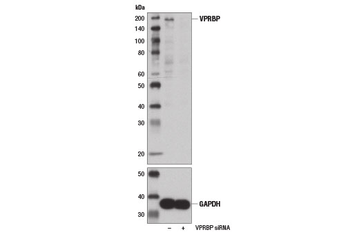 Western blot analysis of extracts from HL-60 cells, transfected with 100 nM SignalSilence ® Control siRNA (Unconjugated) #6568 (-) or SignalSilence ® VPRBP siRNA I (+), using VPRBP Antibody #13931 and GAPDH (D16H11) XP ® Rabbit mAb #5174. The VPRBP Antibody confirms silencing of VPRBP expression, while the GAPDH (D16H11) XP ® Rabbit mAb is used as a loading control.