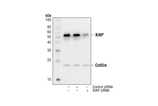 Western blot analysis of extracts from A549 cells, mock transfected or transfected with non-targeted (control) siRNA or SignalSilence ® XIAP siRNA I, using XIAP Antibody #2042 and Cofilin Antibody #3312. The XIAP antibody confirms silencing of XIAP expression, while the cofilin antibody is used to control for protein loading and specificity of XIAP siRNA.