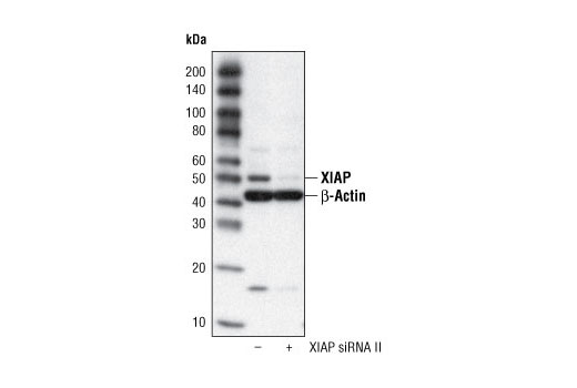 Western blot analysis of extracts from HeLa cells, transfected with 100 nM SignalSilence ® Control siRNA (Fluorescein Conjugate) #6201 (-) or SignalSilence ® XIAP siRNA II (+), using XIAP Antibody #2042 and β-Actin Antibody #4967. The XIAP antibody confirms silencing of XIAP expression, while the β-Actin Antibody is used to control for loading and specificity of XIAP siRNA.