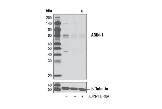 Western blot analysis of extracts from OVCAR8 cells, transfected with 100 nM SignalSilence ® Control siRNA (Unconjugated) #6568 (-), SignalSilence ® ABIN-1 siRNA I #6603 (+) or SignalSilence ® ABIN-1 siRNA II (+), using ABIN-1 Antibody #4664 (upper) or β-Tubulin (9F3) Rabbit mAb #2128 (lower). The ABIN-1 Antibody confirms silencing of ABIN-1 expression, while the β-Tubulin (9F3) Rabbit mAb is used as a loading control.