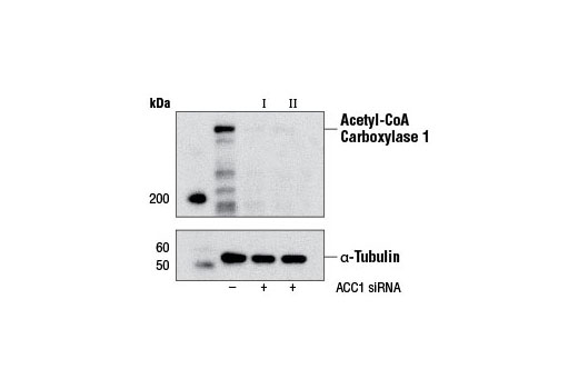 Western blot analysis of extracts from NIH/3T3 cells, transfected with 100 nM SignalSilence ® Control siRNA (Unconjugated) #6568 (-), SignalSilence ® Acetyl-CoA Carboxylase 1 siRNA I #6397 (Mouse Specific) (+), or SignalSilence ® Acetyl-CoA Carboxylase 1 siRNA II (Mouse Specific) (+), using Acetyl-CoA Carboxylase 1 Antibody #4190 (upper) or α-Tubulin (11H10) Rabbit mAb #2125 (lower). The Acetyl-CoA Carboxylase 1 Antibody confirms silencing of Acetyl-CoA Carboxylase 1 expression, while the α-Tubulin (11H10) Rabbit mAb is used as a loading control.