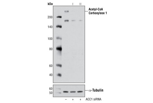Western blot analysis of extracts from HeLa cells, transfected with 100 nM SignalSilence ® Control siRNA (Unconjugated) #6568 (-), SignalSilence ® Acetyl-CoA Carboxylase 1 siRNA I (+) or SignalSilence ® Acetyl-CoA Carboxylase 1 siRNA II #6237 (+), using Acetyl-CoA Carboxylase 1 Antibody #4190 and α-Tubulin (11H10) Rabbit mAb #2125. The Acetyl-CoA Carboxylase 1 antibody confirms silencing of Acetyl-CoA Carboxylase 1 expression while the α-Tubulin (11H10) Rabbit mAb is used as a loading control.