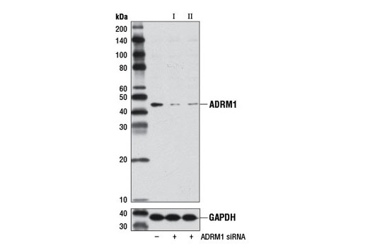 Western blot analysis of extracts from 293T cells, transfected with 100 nM SignalSilence ® Control siRNA (Unconjugated) #6568 (-), SignalSilence ® ADRM1 siRNA I (+), or SignalSilence ® ADRM1 siRNA II #8536 (+), using ADRM1 Antibody #8549 (upper) or GAPDH (D16H11) XP ® Rabbit mAb #5174 (lower). The ADRM1 Antibody confirms silencing of ADRM1 expression, while the GAPDH (D16H11) XP ® Rabbit mAb is used as a loading control.