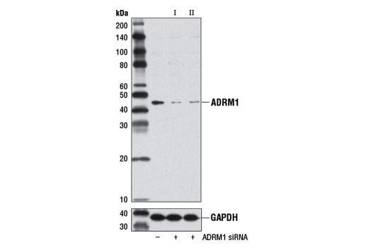 Western blot analysis of extracts from 293T cells, transfected with 100 nM SignalSilence ® Control siRNA (Unconjugated) #6568 (-), SignalSilence ® ADRM1 siRNA I #7981 (+), or SignalSilence ® ADRM1 siRNA II (+), using ADRM1 Antibody #8549 (upper) or GAPDH (D16H11) XP ® Rabbit mAb #5174 (lower). The ADRM1 Antibody confirms silencing of ADRM1 expression, while the GAPDH (D16H11) XP ® Rabbit mAb is used as a loading control.