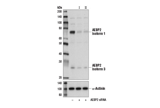 Western blot analysis of extracts from HeLa cells, transfected with 100 nM SignalSilence ® Control siRNA (Unconjugated) #6568 (-), SignalSilence ® AEBP2 siRNA I (+), or SignalSilence ® AEBP2 siRNA II #14713 (+), using AEBP2 (D7C6X) Rabbit mAb #14129 (upper) and α-Actinin (D6F6) XP ® Rabbit mAb #6487 (lower). The AEBP2 (D7C6X) Rabbit mAb confirms silencing of AEBP2 expression, while the α-Actinin (D6F6) XP ® Rabbit mAb is used as a loading control.