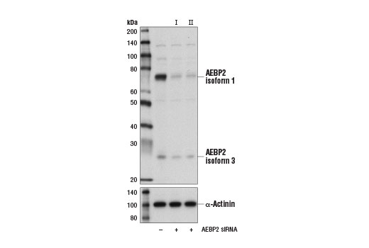 Western blot analysis of extracts from HeLa cells, transfected with 100 nM SignalSilence ® Control siRNA (Unconjugated) #6568 (-), SignalSilence ® AEBP2 siRNA I #14711 (+), or SignalSilence ® AEBP2 siRNA II (+), using AEBP2 (D7C6X) Rabbit mAb #14129 (upper) and α-Actinin (D6F6) XP ® Rabbit mAb #6487 (lower). The AEBP2 (D7C6X) Rabbit mAb confirms silencing of AEBP2 expression, while the α-Actinin (D6F6) XP ® Rabbit mAb is used as a loading control.