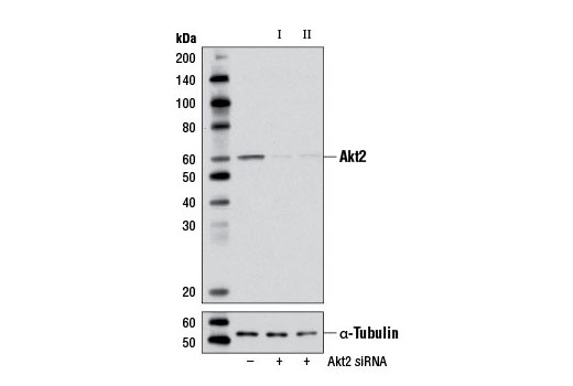 Western blot analysis of extracts from NIH/3T3 cells, transfected with 100 nM SignalSilence ® Control siRNA (Unconjugated) #6568 (-), SignalSilence ® Akt2 siRNA I (Mouse Specific) #6407 (+), or SignalSilence ® Akt2 siRNA II (Mouse Specific) (+) using Akt2 (D6G4) Rabbit mAb #3063 (upper) or α-Tubulin (11H10) Rabbit mAb #2125 (lower). The Akt2 (D6G4) Rabbit mAb confirms silencing of Akt2 expression, while the α-Tubulin (11H10) Rabbit mAb is used as a loading control.