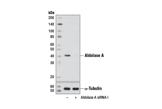 Western blot analysis of extracts from HeLa cells, transfected with 100 nM SignalSilence ® Control siRNA (Unconjugated) #6568 (-) or SignalSilence ® Aldolase A siRNA I (+), using Aldolase Antibody #3188 and α-Tubulin (11H10) Rabbit mAb #2125. The Aldolase Antibody confirms silencing of aldolase A expression, while the α-Tubulin (11H10) Rabbit mAb is used as a loading control.