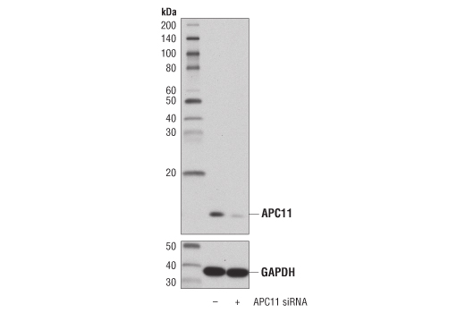 Western blot analysis of extracts from 293T cells, transfected with 100 nM SignalSilence ® Control siRNA (Unconjugated) #6568 (-) or SignalSilence ® APC11 siRNA I (+), using APC11 (D1E7Q) Rabbit mAb #14090 (upper) and GAPDH (D16H11) XP ® Rabbit mAb #5174 (lower). The APC11 (D1E7Q) Rabbit mAb confirms silencing of APC11, while the GAPDH (D16H11) XP ® Rabbit mAb is used as a loading control.