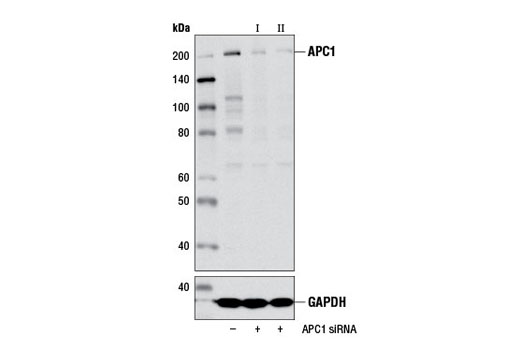Western blot analysis of extracts from 293T cells, transfected with 100 nM SignalSilence ® Control siRNA (Unconjugated) #6568 (-), SignalSilence ® APC1 siRNA I #13441 (+), or SignalSilence ® APC1 siRNA II (+), using APC1 (D1E9D) Rabbit mAb #13329 (upper) or GAPDH (D16H11) XP ® Rabbit mAb #5174 (lower). The APC1 (D1E9D) Rabbit mAb confirms silencing of APC1 expression, while the GAPDH (D16H11) XP ® Rabbit mAb is used as a loading control.
