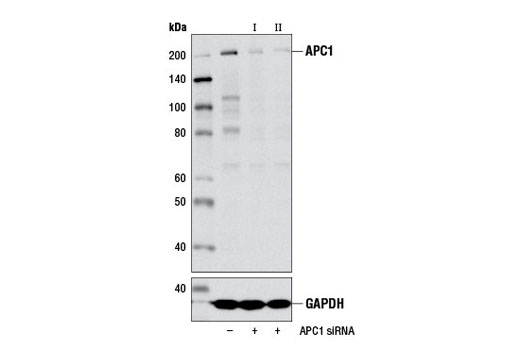 Western blot analysis of extracts from 293T cells, transfected with 100 nM SignalSilence ® Control siRNA (Unconjugated) #6568 (-), SignalSilence ® APC1 siRNA I (+), or SignalSilence ® APC1 siRNA II #13506 (+), using APC1 (D1E9D) Rabbit mAb #13329 (upper) or GAPDH (D16H11) XP ® Rabbit mAb #5174 (lower). The APC1 (D1E9D) Rabbit mAb confirms silencing of APC1 expression, while the GAPDH (D16H11) XP ® Rabbit mAb is used as a loading control.