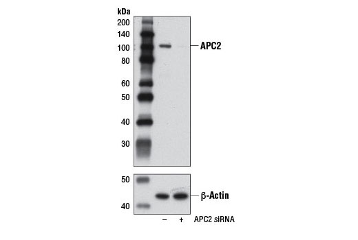 Western blot analysis of extracts from 293T cells, transfected with 100 nM SignalSilence ® Control siRNA (Unconjugated) #6568 (-) or SignalSilence ® APC2 siRNA I (+), using APC2 Antibody #12301 (upper) or β-Actin (D6A8) Rabbit mAb #8457 (lower). The APC2 Antibody confirms silencing of APC2 expression, while the β-Actin (D6A8) Rabbit mAb is used as a loading control.