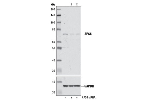 Western blot analysis of extracts from 293T cells, transfected with 100 nM SignalSilence ® Control siRNA (Unconjugated) #6568 (-), SignalSilence ® APC6 siRNA I #7279 (+) or SignalSilence ® APC6 siRNA II (+), using APC6 (D8D8) Rabbit mAb #9499 (upper) or GAPDH (D16H11) XP ® Rabbit mAb #5174 (lower). The APC6 (D8D8) Rabbit mAb confirms silencing of APC6 expression, while the GAPDH (D16H11) XP ® Rabbit mAb is used as a loading control.