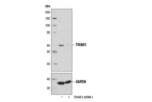 Western blot analysis of extracts from 293T cells, transfected with 100 nM SignalSilence ® Control siRNA (Unconjugated) #6568 (-) or SignalSilence ® TRIAD1 siRNA I (+), using TRIAD1 Antibody #13689 (upper) or GAPDH (D16H11) XP ® Rabbit mAb #5174 (lower). The TRIAD1 Antibody confirms silencing of TRIAD1 expression, while the GAPDH (D16H11) XP ® Rabbit mAb is used as a loading control.
