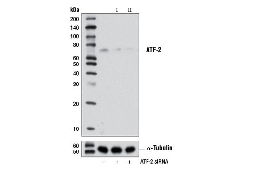 Western blot analysis of extracts from ACHN cells, transfected with 100 nM SignalSilence ® Control siRNA (Unconjugated) #6568 (-), SignalSilence ® ATF-2 siRNA I (+) or SignalSilence ® ATF-2 siRNA II #6443 (+), using ATF-2 (20F1) Rabbit mAb #9226 (upper) or α-Tubulin (11H10) Rabbit mAb #2125 (lower). The ATF-2 (20F1) Rabbit mAb confirms silencing of ATF-2 expression, while the α-Tubulin (11H10) Rabbit mAb is used as a loading control.