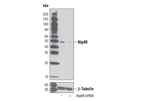 Western blot analysis of extracts from HeLa cells, transfected with 100 nM SignalSilence ® Control siRNA (Unconjugated) #6568 (-) or SignalSilence ® Atg4B siRNA I (+), using Atg4B Antibody #5299 (upper) or β-Tubulin (9F3) Rabbit mAb #2128 (lower). The Atg4B Antibody confirms silencing of Atg4B expression, while the β-Tubulin (9F3) Rabbit mAb is used as a loading control.