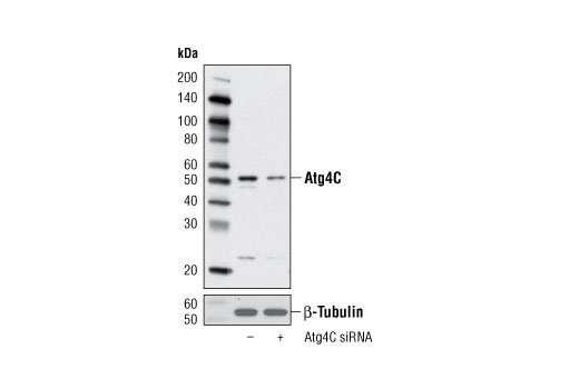 Western blot analysis of extracts from HeLa cells, transfected with 100 nM SignalSilence ® Control siRNA (Unconjugated) #6568 (-) or SignalSilence ® Atg4C siRNA I (+), using Atg4C Antibody #5262 (upper) or β-Tubulin (9F3) Rabbit mAb #2128 (lower). The Atg4C Antibody confirms silencing of Atg4C expression, while the β-Tubulin (9F3) Rabbit mAb is used as a loading control.