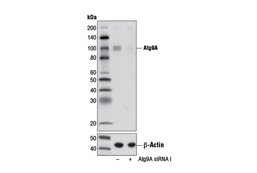 Western blot analysis of extracts from RD cells, transfected with 100 nM SignalSilence ® Control siRNA (Unconjugated) #6568 (-) or SignalSilence ® Atg9A siRNA I (+), using Atg9A Antibody #9730 (upper) or β-Actin (D6A8) Rabbit mAb #8457 (lower). The Atg9A Antibody confirms silencing of Atg9A expression, while the β-Actin (D6A8) Rabbit mAb is used as a loading control.