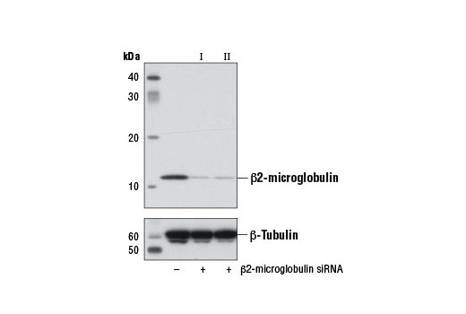Western blot analysis of extracts from HeLa cells, transfected with 100 nM SignalSilence ® Control siRNA (Unconjugated) #6568 (-), SignalSilence ® β2-microglobulin siRNA I #7759 (+), or SignalSilence ® β2-microglobulin siRNA II (+), using β2-microglobulin Antibody #9899 (upper) or β-Tubulin (9F3) Rabbit mAb #2128 (lower). The β2-microglobulin Antibody confirms silencing of β2-microglobulin expression, while the β-Tubulin (9F3) Rabbit mAb is used as a loading control.