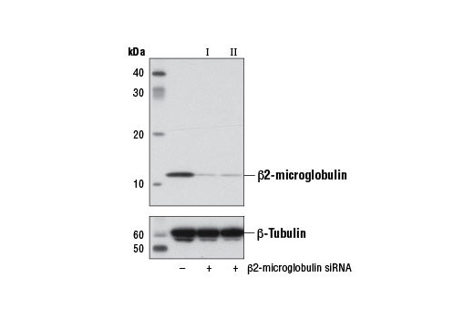 Western blot analysis of extracts from HeLa cells, transfected with 100 nM SignalSilence ® Control siRNA (Unconjugated) #6568 (-), SignalSilence ® β2-microglobulin siRNA I (+), or SignalSilence ® β2-microglobulin siRNA II #7774 (+), using β2-microglobulin Antibody #9899 (upper) or β-Tubulin (9F3) Rabbit mAb #2128 (lower). The β2-microglobulin Antibody confirms silencing of β2-microglobulin expression, while the β-Tubulin (9F3) Rabbit mAb is used as a loading control.