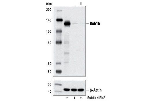 Western blot analysis of extracts from HeLa cells, transfected with 100 nM SignalSilence ® Control siRNA (Unconjugated) #6568 (-), SignalSilence ® Bub1b siRNA I #6623 (+), or SignalSilence ® Bub1b siRNA II (+), using Bub1b (D32E8) Rabbit mAb #5421 (upper) or β-Actin (D6A8) Rabbit mAb #8457 (lower). The Bub1b (D32E8) Rabbit mAb confirms silencing of Bub1b expression, while the β-Actin (D6A8) Rabbit mAb is used as a loading control.