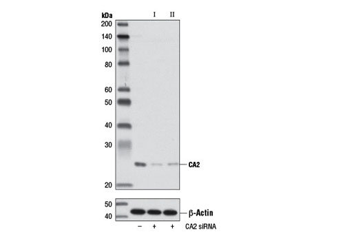 Western blot analysis of extracts from 293T cells, transfected with 100 nM SignalSilence ® Control siRNA (Unconjugated) #6568 (-), SignalSilence ® CA2 siRNA I (+) or SignalSilence ® CA2 siRNA II #7589 (+), using CA2 Antibody #8612 (upper) or β-Actin (13E5) Rabbit mAb #4970 (lower). The CA2 Antibody confirms silencing of CA2 expression, while the β-Actin (13E5) Rabbit mAb is used as a loading control.