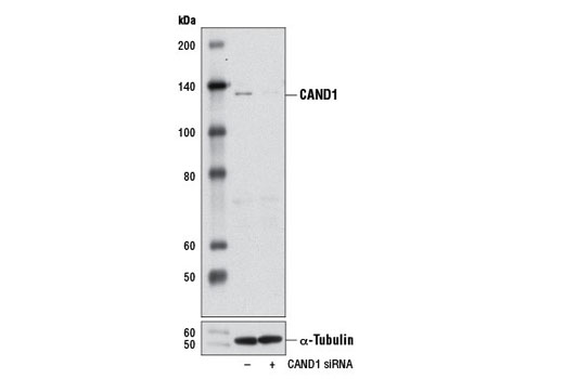 Western blot analysis of extracts from 293 cells, transfected with 100 nM SignalSilence ® Control siRNA (Unconjugated) #6568 (-) or SignalSilence ® CAND1 siRNA I (+), using CAND1 Antibody #7433 (upper) or α-Tubulin (11H10) Rabbit mAb #2125 (lower). The CAND1 Antibody confirms silencing of CAND1 expression, while the α-Tubulin (11H10) Rabbit mAb is used as a loading control.