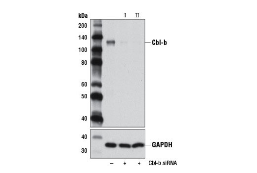 Western blot analysis of extracts from 293T cells, transfected with 100 nM SignalSilence ® Control siRNA (Unconjugated) #6568 (-), SignalSilence ® Cbl-b siRNA I #12130 (+), or SignalSilence ® Cbl-b siRNA II (+), using Cbl-b (D3C12) Rabbit mAb #9498 (upper) or GAPDH (D16H11) XP ® Rabbit mAb #5174 (lower). The Cbl-b (D3C12) Rabbit mAb confirms silencing of Cbl-b expression, while the GAPDH (D16H11) XP ® Rabbit mAb is used as a loading control.