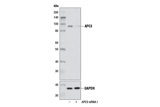 Western blot analysis of extracts from 293T cells, transfected with 100 nM SignalSilence ® Control siRNA (Unconjugated) #6568 (-) or SignalSilence ® APC3 siRNA I (+), using APC3 Antibody #9063 (upper) or GAPDH (D16H11) XP ® Rabbit mAb #5174 (lower). The APC3 Antibody confirms silencing of APC3 expression, while the GAPDH (D16H11) XP ® Rabbit mAb is used as a loading control.