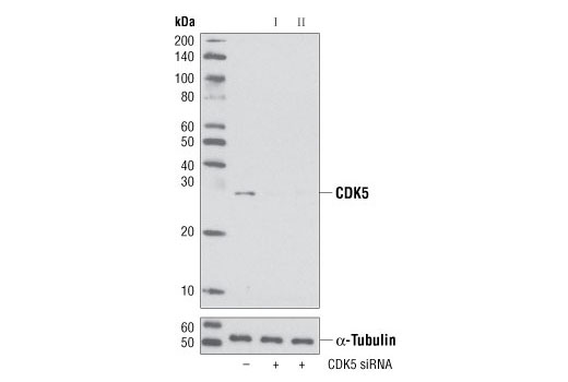 Western blot analysis of extracts from HeLa cells, transfected with 100 nM SignalSilence ® Control siRNA (Unconjugated) #6568 (-), SignalSilence ® CDK5 siRNA I #6216 (+) or SignalSilence ® CDK5 siRNA II (+), using CDK5 Antibody #2506 (upper) or α-Tubulin (11H10) Rabbit mAb #2125 (lower). The CDK5 Antibody confirms silencing of CDK5 expression, while the α-Tubulin (11H10) Rabbit mAb is used to control for loading and specificity of CDK5 siRNA.