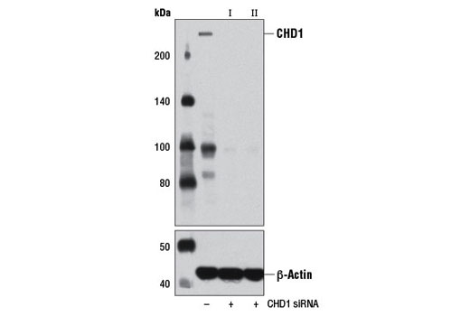 Western blot analysis of extracts from HeLa cells, transfected with 100 nM SignalSilence ® Control siRNA (Unconjugated) #6568 (-), SignalSilence ® CHD1 siRNA I #7168 (+), or SignalSilence ® CHD1 siRNA II (+), using CHD1 (D8C2) Rabbit mAb #4351 (upper) or β-Actin (D6A8) Rabbit mAb #8457 (lower). The CHD1 (D8C2) Rabbit mAb confirms silencing of CHD1 expression, while the β-Actin (D6A8) Rabbit mAb is used as a loading control.