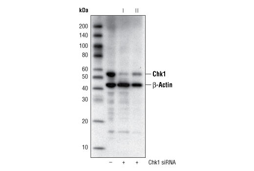 Western blot analysis of extracts from HeLa cells, transfected with 100 nM SignalSilence ® Control siRNA (Fluorescein Conjugate) #6201 (-) or SignalSilence ® Chk1 siRNA I #6241 or SignalSilence ® Chk1 siRNA II (+), using Chk1 (2G1D5) Mouse mAb #2360 and β-Actin (13E5) Rabbit mAb #4970. Chk1 (2G1D5) Mouse mAb confirms silencing of Chk1 expression and β-Actin (13E5) Rabbit mAb is used to control for loading and specificity of Chk1 siRNA.