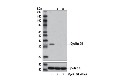 Western blot analysis of extracts from MCF7 cells, transfected with 100 nM SignalSilence ® Control siRNA (Unconjugated) #6568 (-), SignalSilence ® Cyclin D1 siRNA I #12962 (+), or SignalSilence ® Cyclin D1 siRNA II (+), using Cyclin D1 (92G2) Rabbit mAb #2978 (upper) or β-Actin (D6A8) Rabbit mAb #8457 (lower). The Cyclin D1 (92G2) Rabbit mAb confirms silencing of cyclin D1 expression, while the β-Actin (D6A8) Rabbit mAb is used as a loading control.