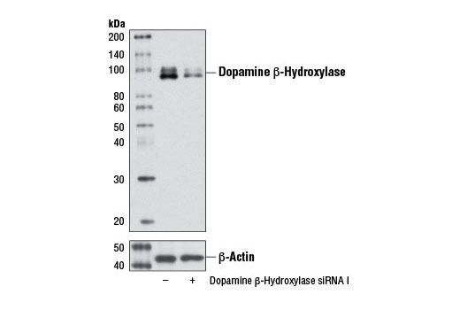 Western blot analysis of extracts from SH-SY5Y cells, transfected with 100 nM SignalSilence ® Control siRNA (Unconjugated) #6568 (-) or SignalSilence ® Dopamine β-Hydroxylase (DBH) siRNA I (+), using Dopamine β-Hydroxylase (DBH) Antibody #8586 (upper) or β-Actin (13E5) Rabbit mAb #4970 (lower). The Dopamine β-Hydroxylase (DBH) Antibody confirms silencing of dopamine β-hydroxylase expression, while the β-Actin (13E5) Rabbit mAb is used as a loading control.