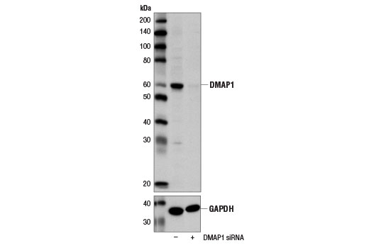 Western blot analysis of extracts from HeLa cells, transfected with 100 nM SignalSilence ® Control siRNA (Unconjugated) #6568 (-) or SignalSilence ® DMAP1 siRNA I (+), using DMAP1 Antibody #13326 (upper) or GAPDH (D16H11) XP ® Rabbit mAb #5174 (lower). The DMAP1 Antibody confirms silencing of DMAP1 expression, while the GAPDH (D16H11) XP ® Rabbit mAb is used as a loading control.