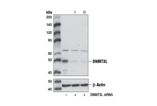 Western blot analysis of extracts from F9 cells, transfected with 100 nM SignalSilence ® Control siRNA (Unconjugated) #6568 (-), SignalSilence ® DNMT3L siRNA I (Mouse Specific) (+), or SignalSilence ® DNMT3L siRNA II (Mouse Specific) #12308 (+), using DNMT3L Antibody (Mouse Specific) #12309 (upper) or β-Actin (D6A8) Rabbit mAb #8457 (lower). The DNMT3L Antibody (Mouse Specific) confirms silencing of DNMT3L expression, while the β-Actin (D6A8) Rabbit mAb is used as a loading control.