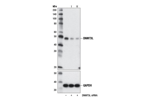 Western blot analysis of extracts from F9 cells, transfected with 100 nM SignalSilence ® Control siRNA (Unconjugated) #6568 (-), SignalSilence ® DNMT3L siRNA I (Mouse Specific) (+), or SignalSilence ® DNMT3L siRNA II (Mouse Specific) #12308 (+), using DNMT3L (E1Y7Q) Rabbit mAb (Mouse Specific) #13451 (upper) or GAPDH (D16H11) XP ® Rabbit mAb #5174 (lower). The DNMT3L (E1Y7Q) Rabbit mAb (Mouse Specific) confirms silencing of DNMT3L expression, while the GAPDH (D16H11) XP ® Rabbit mAb is used as a loading control.