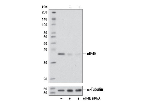 Western blot analysis of extracts from C2C12 cells, transfected with 100 nM SignalSilence ® Control siRNA (Unconjugated) #6568 (-), SignalSilence ® eIF4E siRNA I (Mouse Specific) #6424 (+), or SignalSilence ® eIF4E siRNA II (Mouse Specific) (+) using eIF4E (C46H6) Rabbit mAb #2067 (upper) or α-Tubulin (11H10) Rabbit mAb #2125 (lower). The eIF4E (C46H6) Rabbit mAb confirms silencing of eIF4E expression, while the α-Tubulin (11H10) Rabbit mAb is used as a loading control.