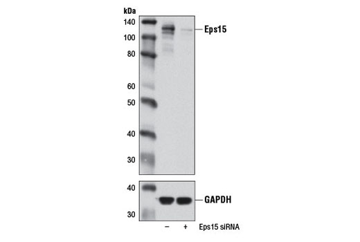 Western blot analysis of extracts from 293T cells, transfected with 100 nM SignalSilence ® Control siRNA (Unconjugated) #6568 (-) or SignalSilence ® Eps15 siRNA I (+), using Eps15 (D3K8R) Rabbit mAb #12460 (upper) or GAPDH (D16H11) XP ® Rabbit mAb #5174 (lower). The Eps15 (D3K8R) Rabbit mAb confirms silencing of Eps15 expression, while the GAPDH (D16H11) XP ® Rabbit mAb is used as a loading control.