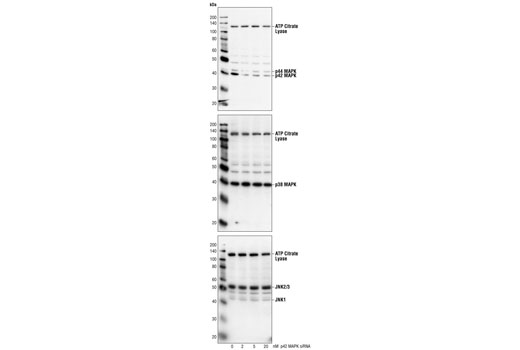 Western blot analysis of extracts from HeLa cells transfected with 20 nM control siRNA #6201 (-) or 2, 5, or 20 nM pool 42 MAPK siRNA, using p44/42 MAP Kinase Antibody #9102 (upper), p38 MAP Kinase Antibody #9212 (middle) and SAPK/JNK (56G8) Rabbit mAb #9258 (lower) in combination with ATP-Citrate Lyase Antibody #4332. The 44/42 MAP Kinase Antibody confirms silencing of p42 MAP Kinase expression, and ATP-Citrate Lyase Antibody is used to control for loading and specificity of pool p42 MAP Kinase siRNA. The experiment also demonstrates specifically that the pool p42 MAPK siRNA does not interfere with the expression of p44 MAPK, p38 MAPK or SAPK/JNKs.