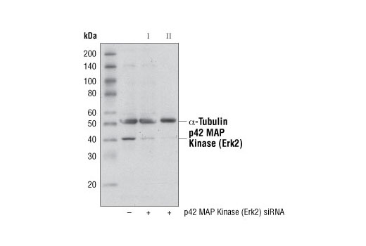 Western blot analysis of extracts from 293 cells, transfected with 100 nM SignalSilence ® Control siRNA (Unconjugated) #6568 (-), SignalSilence® p42 MAP Kinase (Erk2) siRNA I (+) or SignalSilence ® p42 MAP Kinase (Erk2) siRNA II #6578 (+), using p42 MAP Kinase (Erk2) Antibody #9108 (upper) or α-Tubulin (11H10) Rabbit mAb #2125 (lower). The p42 MAP Kinase (Erk2) Antibody confirms silencing of p42 MAP Kinase (Erk2) expression, while the α-Tubulin (11H10) Rabbit mAb is used as a loading control.