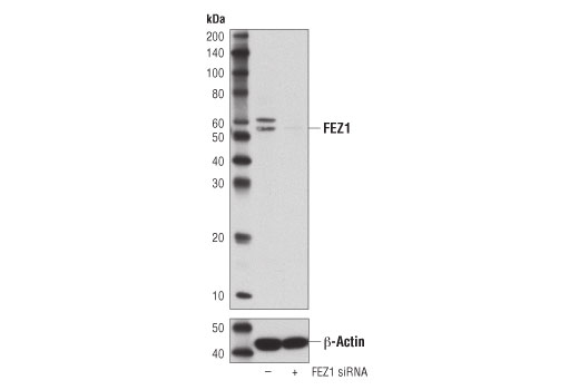 Western blot analysis of extracts from Malme-3M cells, transfected with 100 nM SignalSilence® Control siRNA (Unconjugated) #6568 (-) or SignalSilence ® FEZ1 siRNA I (+), using FEZ1 (D9R8Q) Rabbit mAb #42480 (upper) or β-Actin (D6A8) Rabbit mAb #8457 (lower). The FEZ1 (D9R8Q) Rabbit mAb confirms silencing of FEZ1 expression, while the β-Actin (D6A8) Rabbit mAb is used as a loading control.