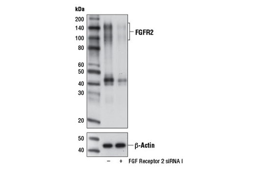 Western blot analysis of extracts from KATO III cells, transfected with 100 nM SignalSilence ® Control siRNA (Unconjugated) #6568 (-) or SignalSilence ® FGF Receptor 2 siRNA I (+), using FGF Receptor 2 (D4H9) Rabbit mAb #11835 (upper) or β-Actin (D6A8) Rabbit mAb #8457 (lower). The FGF Receptor 2 (D4H9) Rabbit mAb confirms silencing of FGF Receptor 2 expression, while the β-Actin (D6A8) Rabbit mAb is used as a loading control.