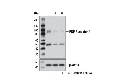 Western blot analysis of extracts from Huh-7 cells, transfected with 100 nM SignalSilence ® Control siRNA (Unconjugated) #6568 (-), SignalSilence ® FGF Receptor 4 siRNA I (+), or SignalSilence ® FGF Receptor 4 siRNA II #12669, using FGF Receptor 4 (D3B12) XP ® Rabbit mAb #8562 (upper) or β-Actin (D6A8) Rabbit mAb #8457 (lower). The FGF Receptor 4 (D3B12) XP ® Rabbit mAb confirms silencing of FGF Receptor 4 expression, while the β-Actin (D6A8) Rabbit mAb is used as a loading control.